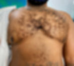Transgender tattoo services