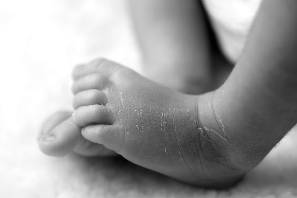 A tender black and white close-up captures the delicate and wrinkled skin of a newborn's foot, evoking the beauty and fragility of new life!