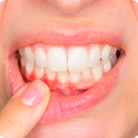 berofeandafter-smile-4.png