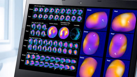 Understanding PET/CT Imaging for Cardiac Patients: A Comprehensive Guide