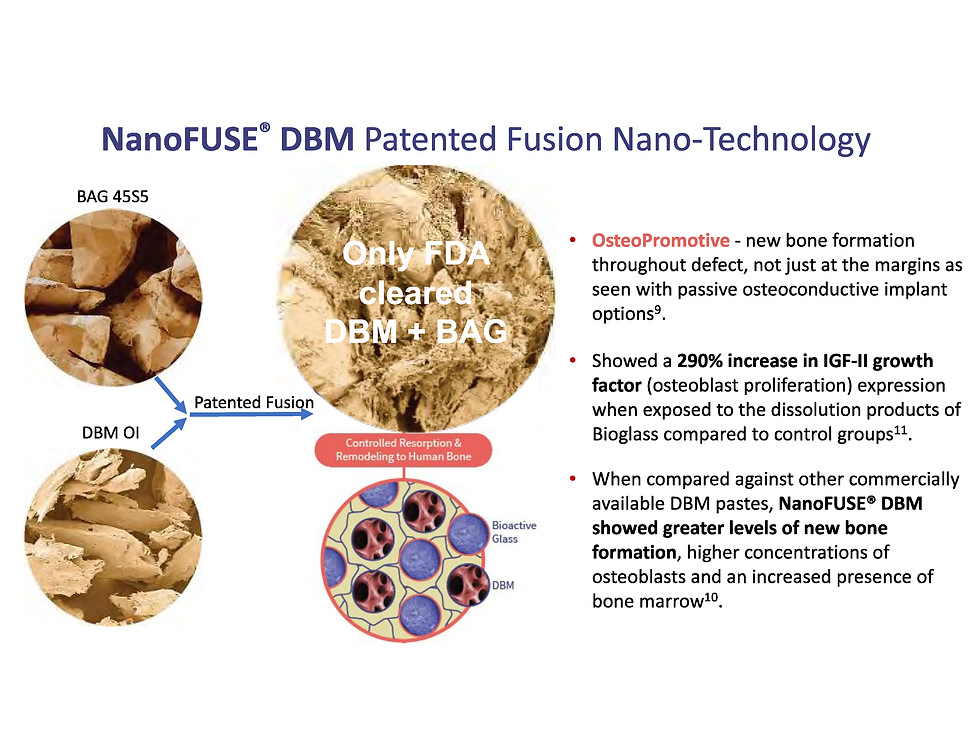 NanoFUSE® DBM bone graft technology featuring a patented combination of demineralized bone matrix and bioactive glass for enhanced spinal fusion and bone regeneration.