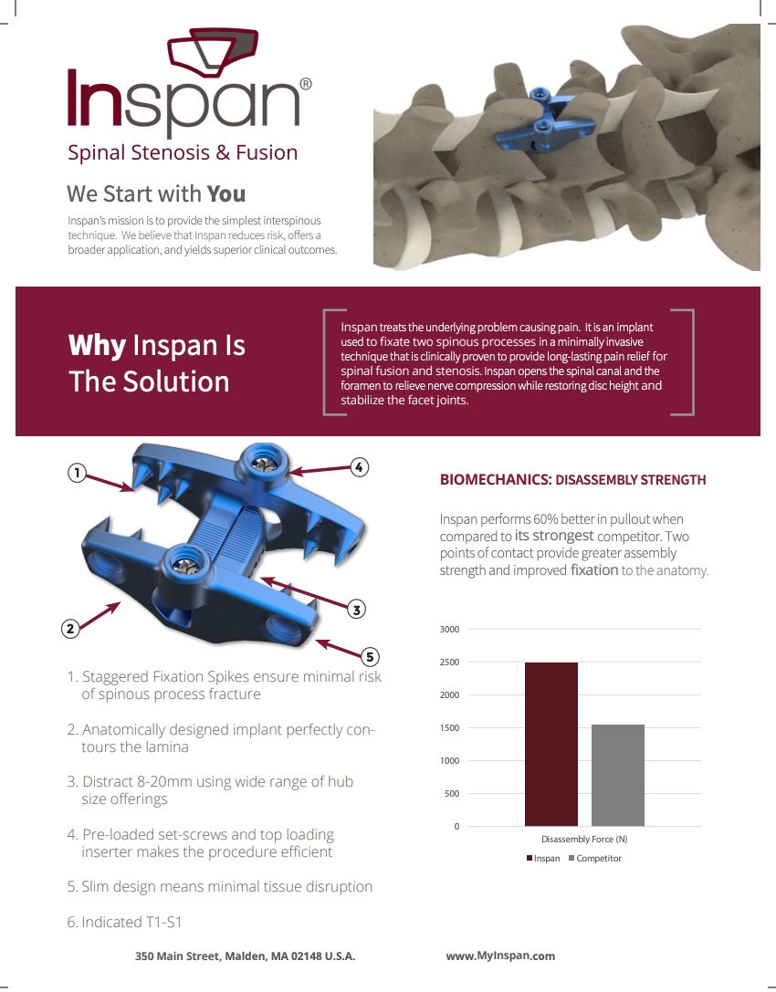 InSpan™ interspinous fixation device designed to stabilize the spine, support fusion, and reduce pain in patients with degenerative spinal conditions.