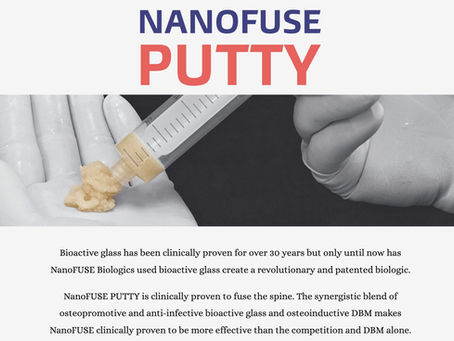 NanoFUSE® Putty bone graft material with bioactive glass and DBM for spinal fusion.