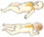 Brown Fat Development Areas As Shown On A Human Baby