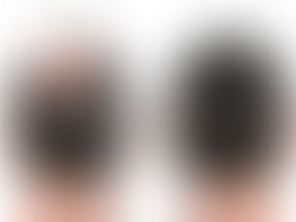 Back view of male head before and after hair extensions