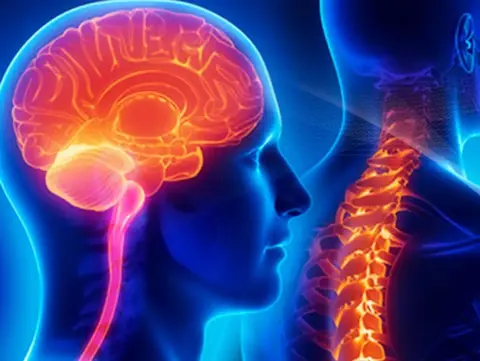 brain injury accident needs personal injury lawyers Burg and Brock