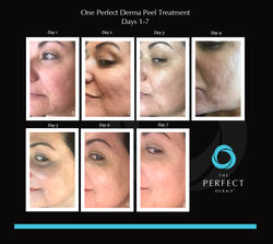Perfect Derma