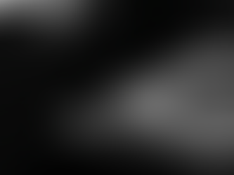 Sintomi di infarto sottovalutati e niente ECG? Quando il ritardo diventa errore medico