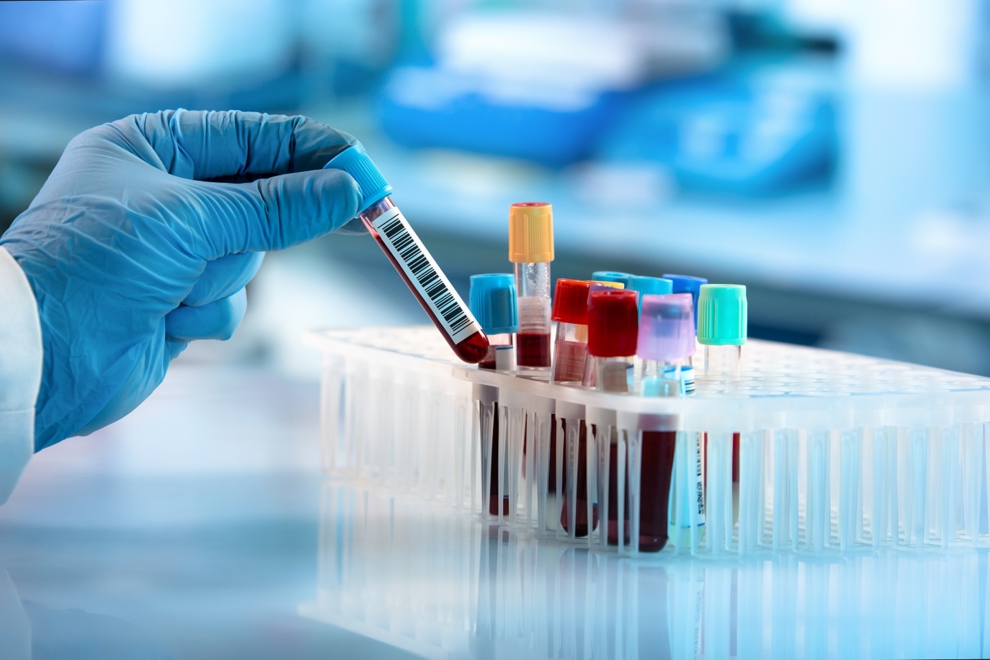 Proteomics bags US patent for endometriosis test