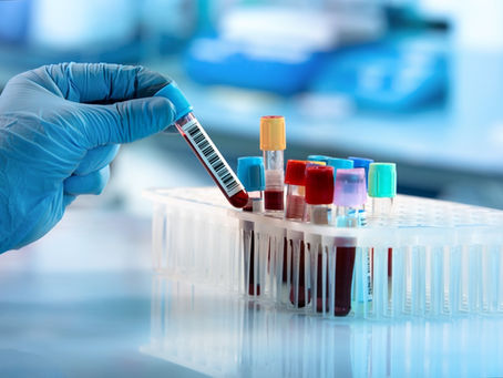 Proteomics bags US patent for endometriosis test