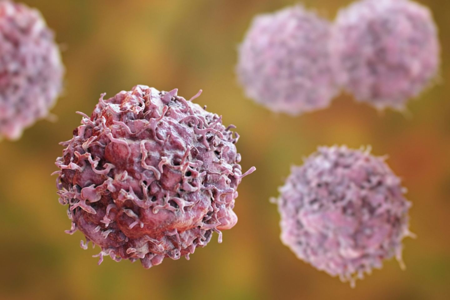 Fresh data backs Amplia push against pancreatic and ovarian cancer