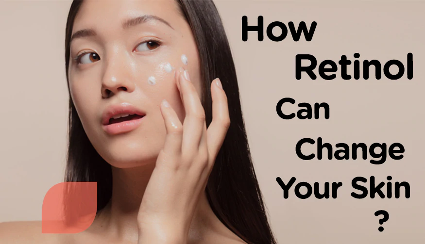Retinoid Creams