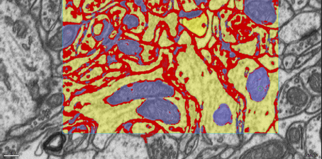 SVISION is awarded two new patents with broad coverage for AI microscopy applications