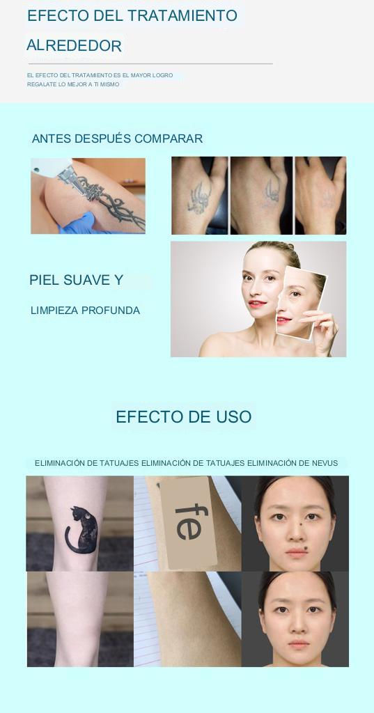 Miniatura: Laser Tridiodo Tipo ZP ice 360 + Picolaser No Invasivo