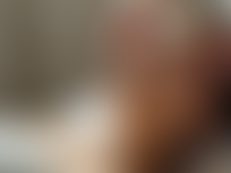 美容鍼灸で美しさを手に入れる方法