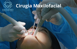 Cirugía Maxilofacial