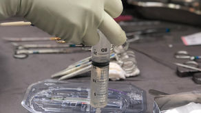 Tratando a espasticidade com "bombas" de Baclofeno