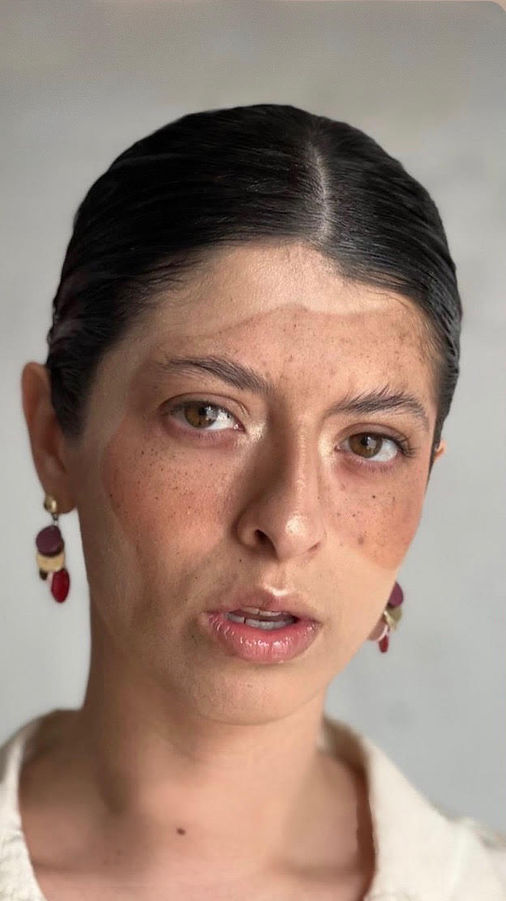 Fotografía de mujer con maquillaje de mancha con pecas en la cara mirando a la cámara.