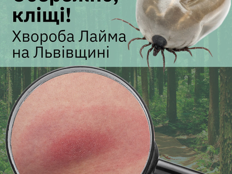 Небезпечний укус: що варто знати про хворобу Лайма