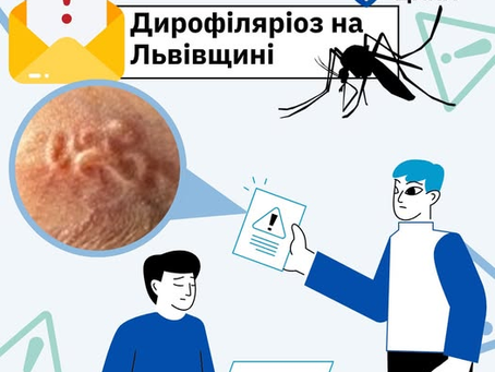З ока львів’янина видалили 12-сантиметрового паразита