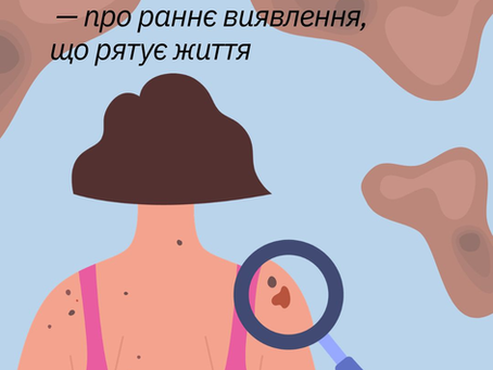 Меланома: чому обізнаність рятує життя
