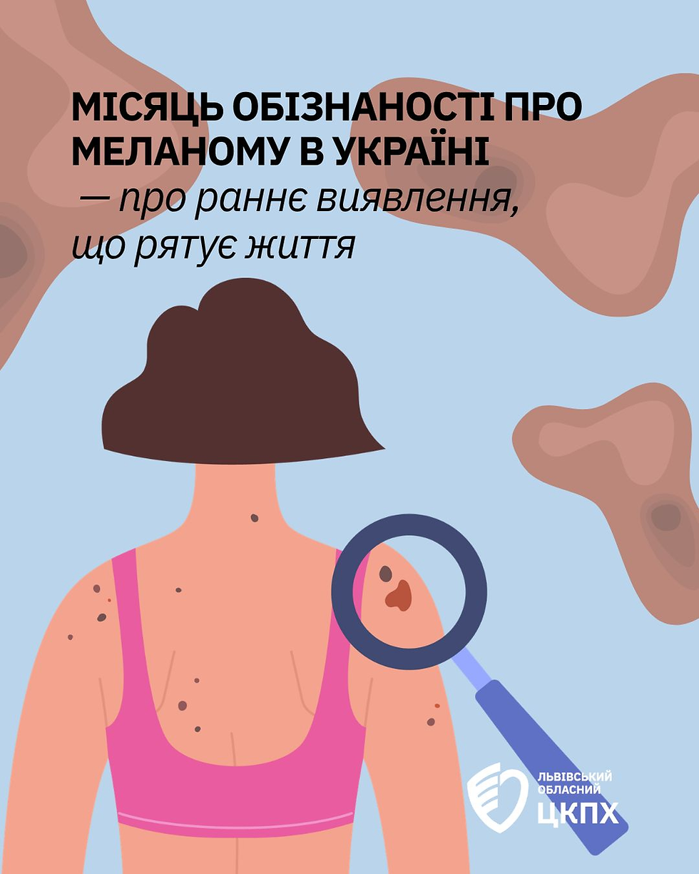 Меланома: чому обізнаність рятує життя