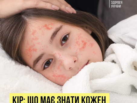 Кір - є одним із найзаразніших захворювань, відомих у світі