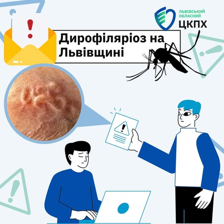 З-під ключиці 73-річної львів’янки хірурги дістали 12-сантиметрового паразита