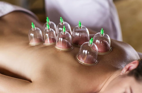 cupping.jpeg