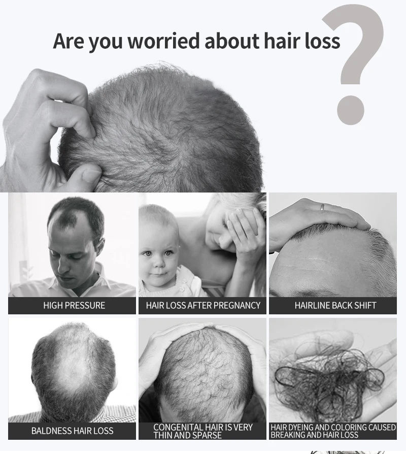 Thumbnail: Hair Growth Serum 7 Days Fast Regrowth Essential Capsule Anti Hair loss Baldness