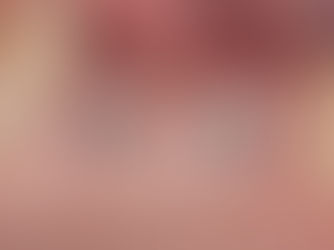 Supracrestal Ceramic Implant Placement as a Soft Tissue–Driven Alternative to Horizontal Regeneration in the Posterior Maxilla: A Case-Based Rationale