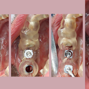 The Mandible Illusion