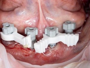 The New 4mm (2.0 Version)