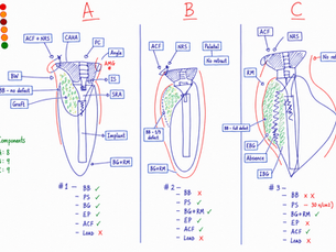 The Last Teeth Standing: Preserving Architecture in the Transition from Natural Teeth to Implants