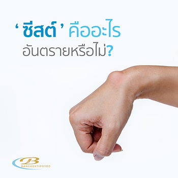 ซีสต์ กรุงเทพทิพโอสถ มะเร็ง
