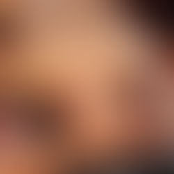 Chica tumbada recibiendo un masaje relajante en Policlínica Henko, rodeada de pétalos de rosa por San Valentín. La paciente está relajada sobre la camilla, con un ambiente cálido y elegante que transmite bienestar, cuidado y autocuidado estético. Escena que refleja serenidad, confort y un momento de mimo personal.