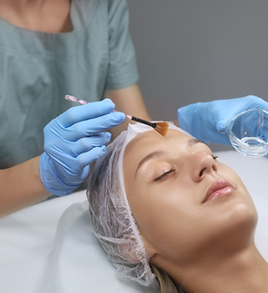 chemical peel photos.png