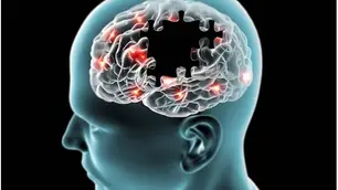World Alzheimer's Month Brain