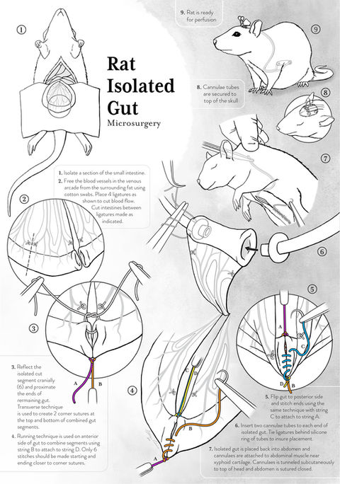 Surgery Illustration
