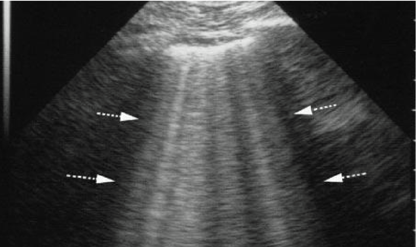 Bedside ECHO & USG in ICU content media