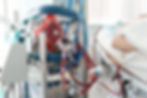 ECMO in ICU