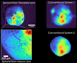 SV vs two conventional systems, GFP labeled tumor ex vivo.png