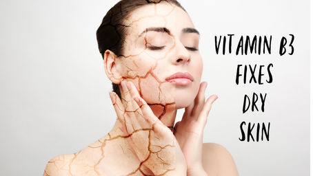 Vitamin B3 (niacinamide) Fixes Dry Skin