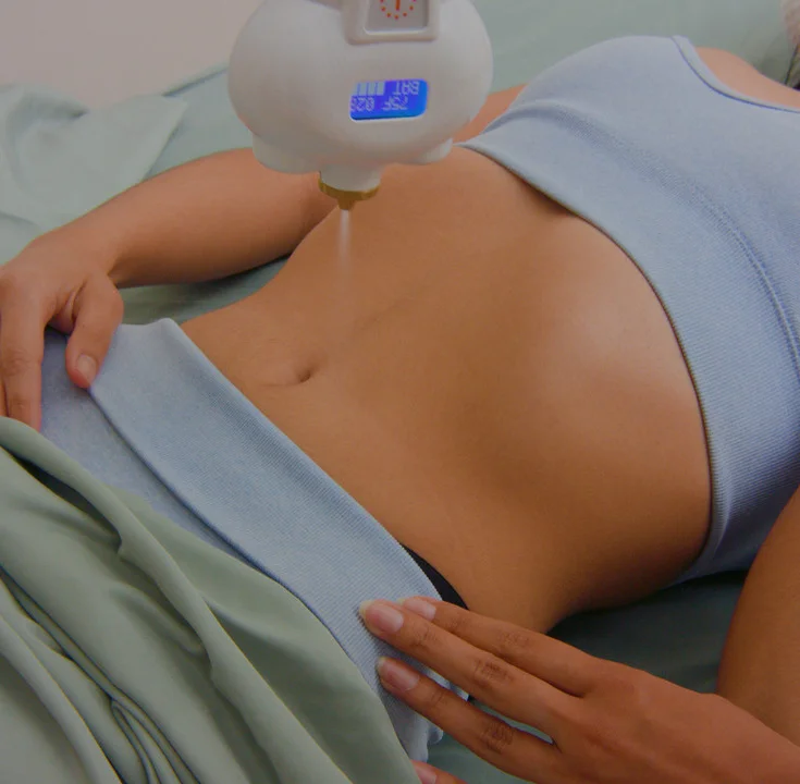 Cryotherapy.webp