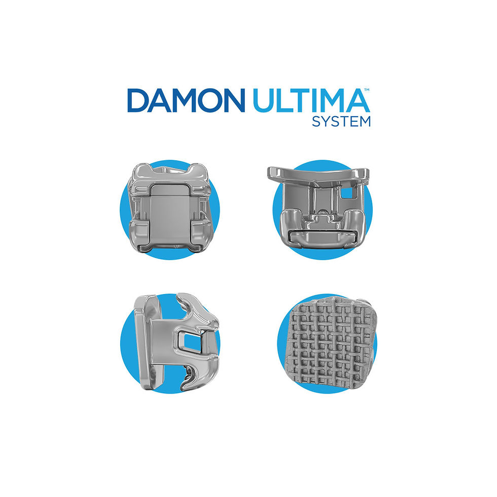 damon-ultima-system.jpg
