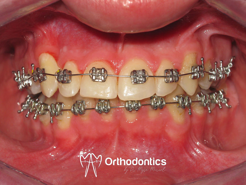 Cojocaru Jadran 11 07 2012 (1).jpg