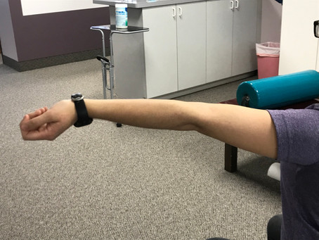 Do I Have Hypermobility?