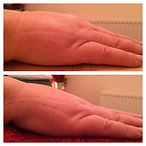 BEFORE & AFTER RLD