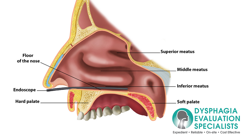 Image of endoscope traveling through the nose during a FEES Swallowing Study