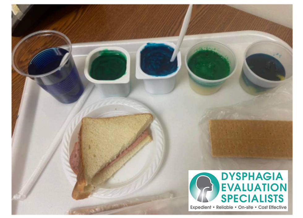 Typical food trials during a FEES swallowing study: Thin liquids, thickened liquids, pureed foods, mixed consistency such as fruit cocktail, soft and hard consistency solids